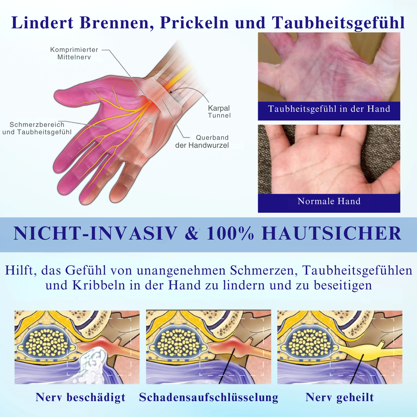 NovaRX® PRO BetäubenWeg CooleLindern Neuropathie-Spray