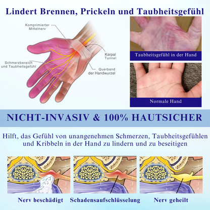 NovaRX® PRO BetäubenWeg CooleLindern Neuropathie-Spray