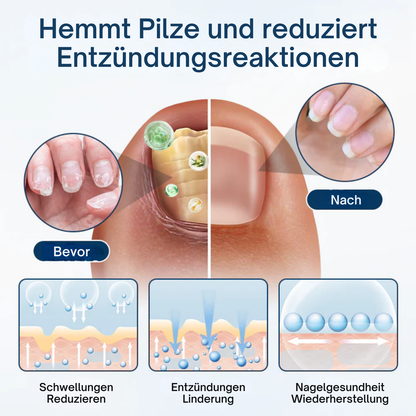 Fivfivgo® OnyxiGuard Profi Pilzreparatur Kräuterspray