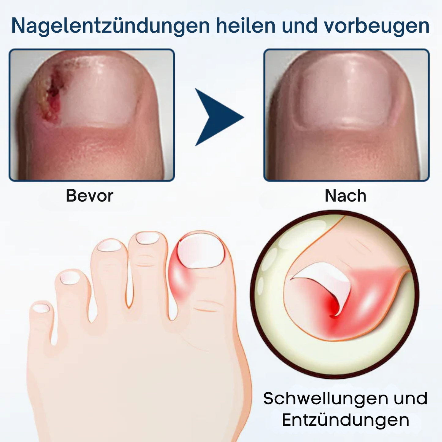 Fivfivgo® OnyxiGuard Profi Pilzreparatur Kräuterspray