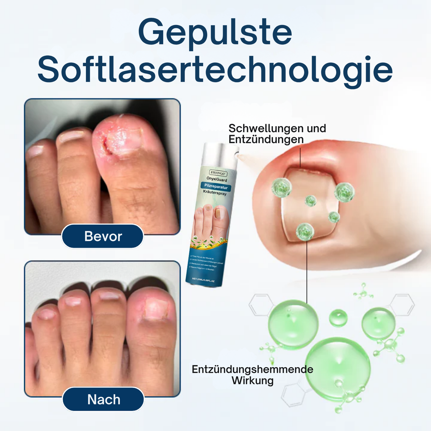 Fivfivgo® OnyxiGuard Profi Pilzreparatur Kräuterspray