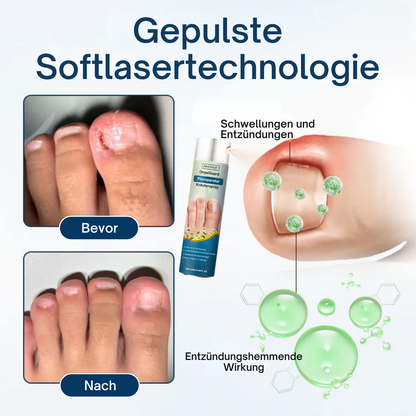 Fivfivgo® OnyxiGuard Profi Pilzreparatur Kräuterspray