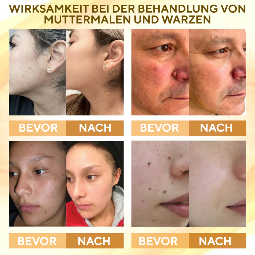 Fivfivgo® Condense Mellifera Gift Hautregenerierende Creme