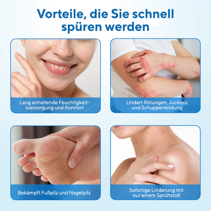 Fivfivgo® MagnesiumHerb Psoriasis-Linderungscreme