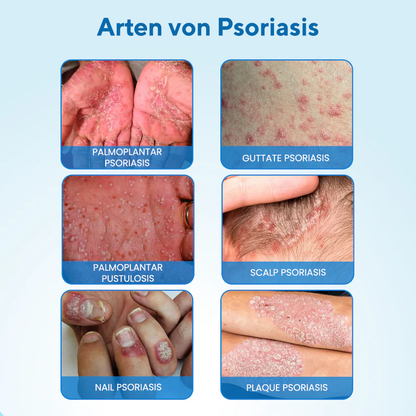 Fivfivgo® MagnesiumHerb Psoriasis-Linderungscreme