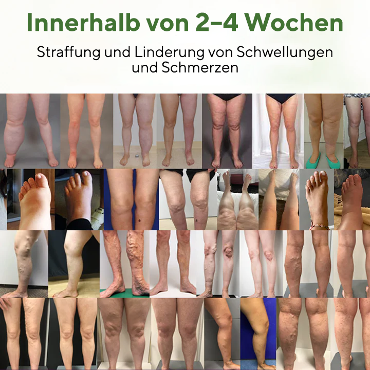 NovaRX® FluidEase PRO Beintherapie-Ödemcreme