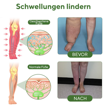 NovaRX® FluidEase PRO Beintherapie-Ödemcreme
