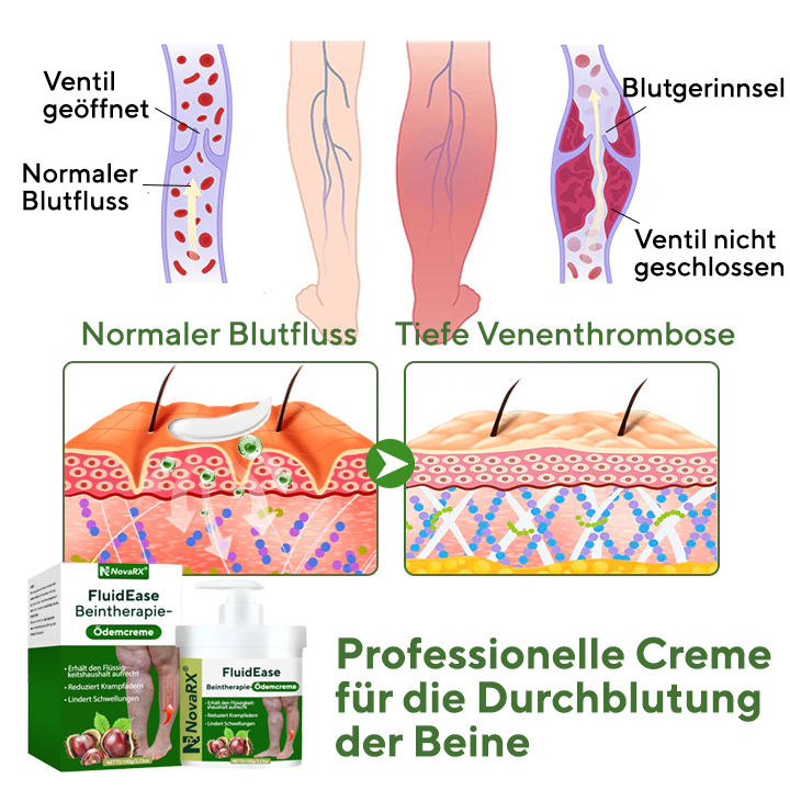 NovaRX® FluidEase PRO Beintherapie-Ödemcreme