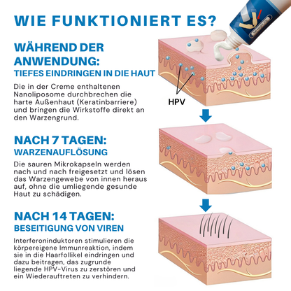 Fivfivgo® HPV-Creme ULTRA zur Linderung genitaler Warzen