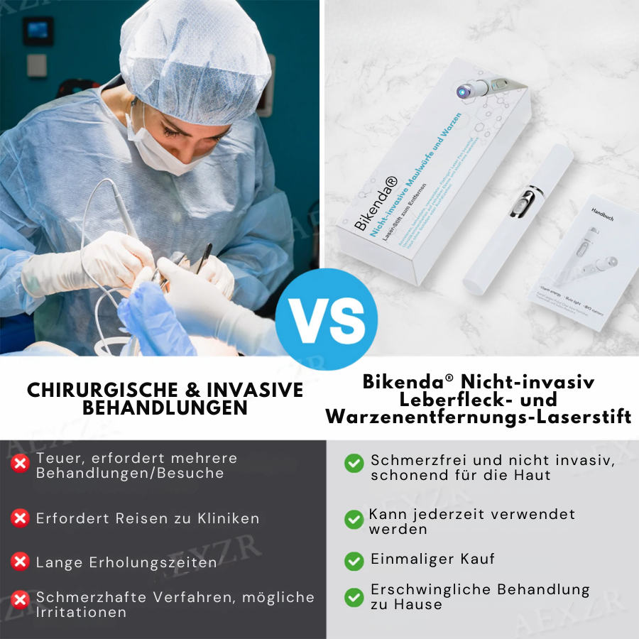 Bikenda® ULTRA Nicht-invasiv Leberfleck- und Warzenentfernungs-Laserstift Exklusiv