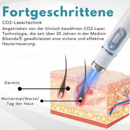 Bikenda® MAX Nicht-invasiv Leberfleck- und Warzenentfernungs-Laserstift
