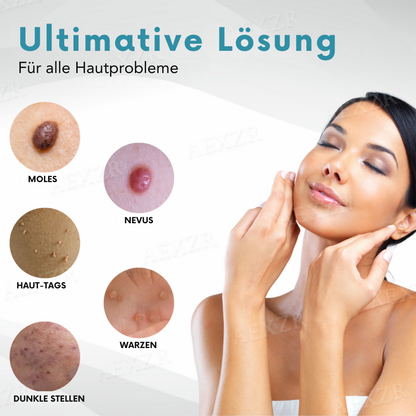 Bikenda® MAX Nicht-invasiv Leberfleck- und Warzenentfernungs-Laserstift